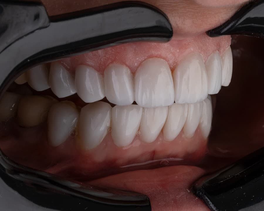 Cosmetic Treatment